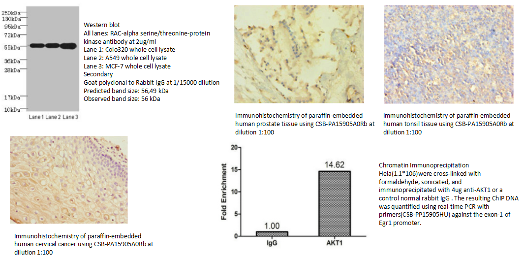 我的后半生——自噬