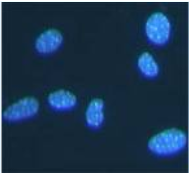 1587863141664407.png 细胞凋亡检测方法