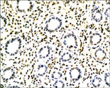 TLR2 (CD282) staining in rat stomach. Paraffin-embedded rat stomach is stained with TLR2 Antibody (Cat. No. 251110) used at 1:200 dilution. 