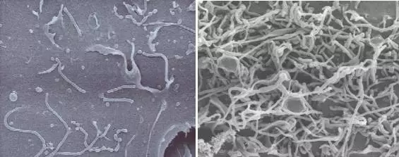 谁动了你的细胞——赶走支原体