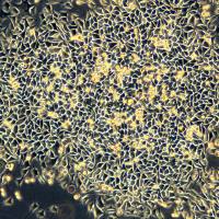 浙江美森-小鼠皮下结缔组织细胞 L-WRN