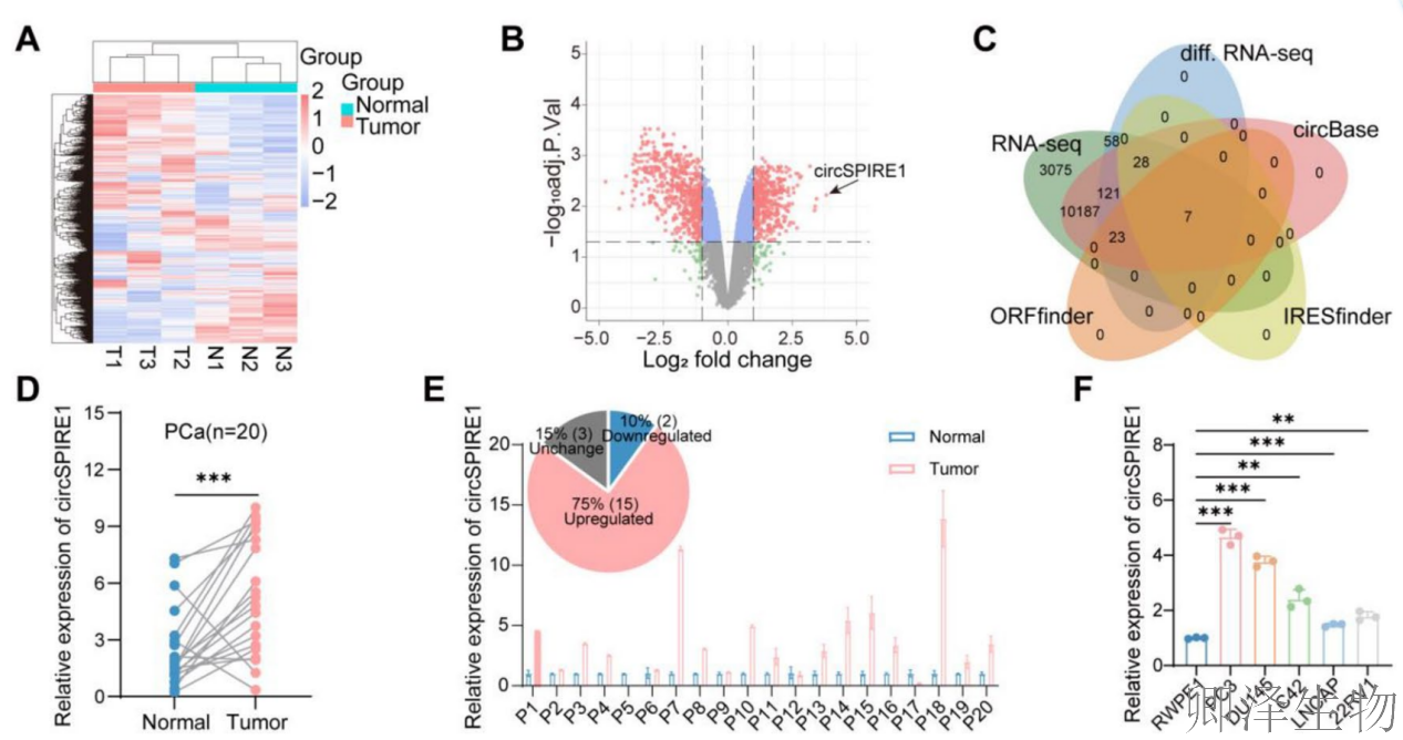 【circRNA翻译】 | 环状RNA编码新型蛋白,成前列腺癌治疗新靶点!