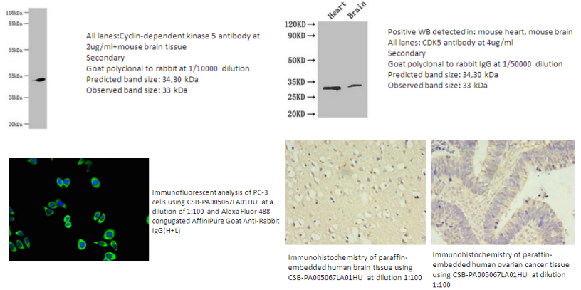我的后半生——自噬