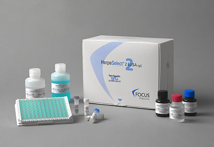 新日揭秘ELISA检测重点技巧有哪些