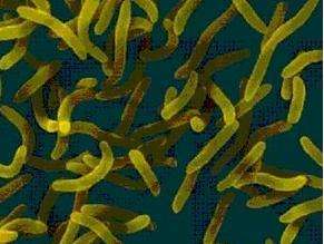 引起急性肠炎的副溶血性弧菌