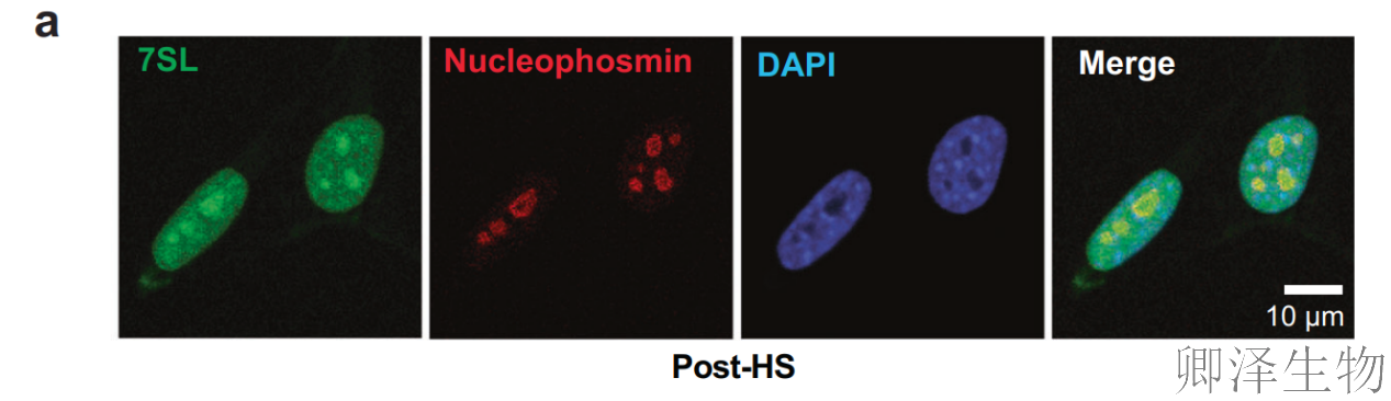 【热应激的翻译调控】 | 7SL RNA与信号识别颗粒（SRP）的双重身份大揭秘！