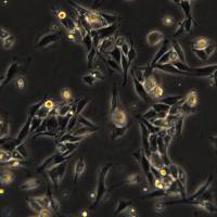 浙江美森-大鼠骨骼肌成肌细胞 L6