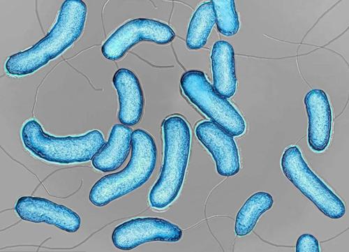 引起霍乱的元凶——霍乱弧菌