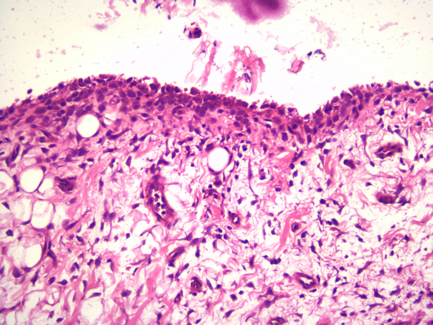 大鼠骨关节炎模型制备 大鼠骨关节炎模型制备