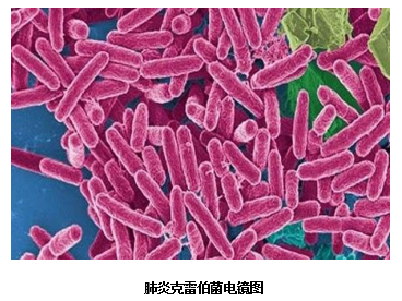 有效分离肺炎克雷伯杆菌的新方法