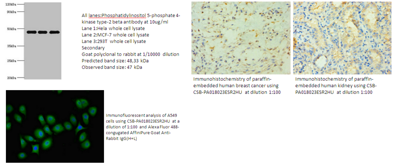 我的后半生——自噬