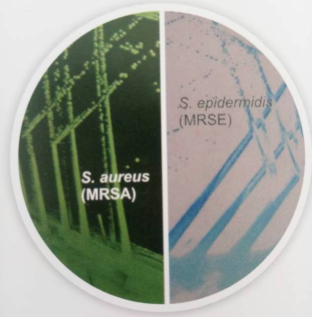 HiCrome™显色培养基快速鉴定细菌，已在国际悄然流行！