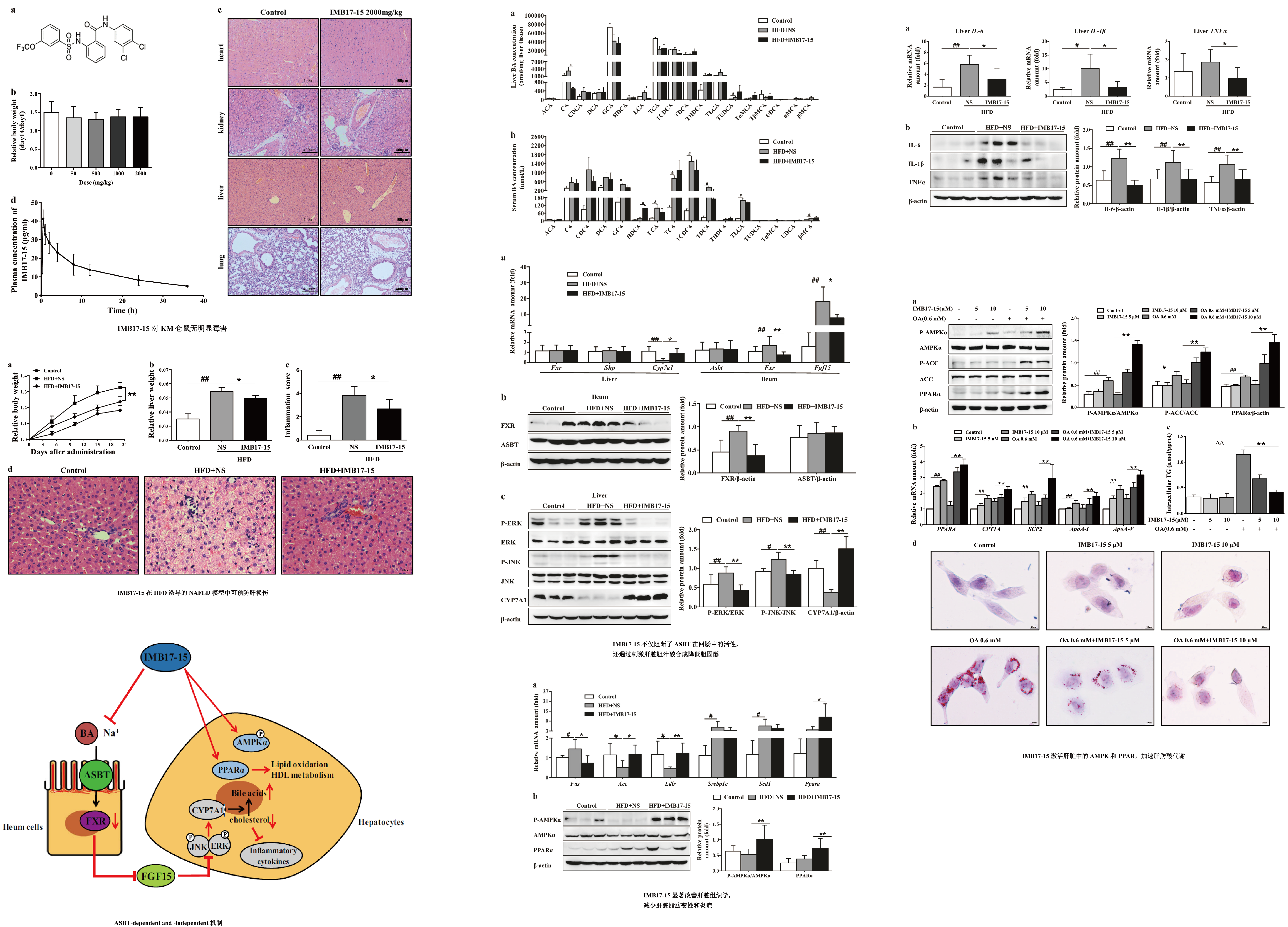 客户案例｜一种新型ASBT抑制剂 - IMB17-15可抑制非酒精性脂肪肝进展