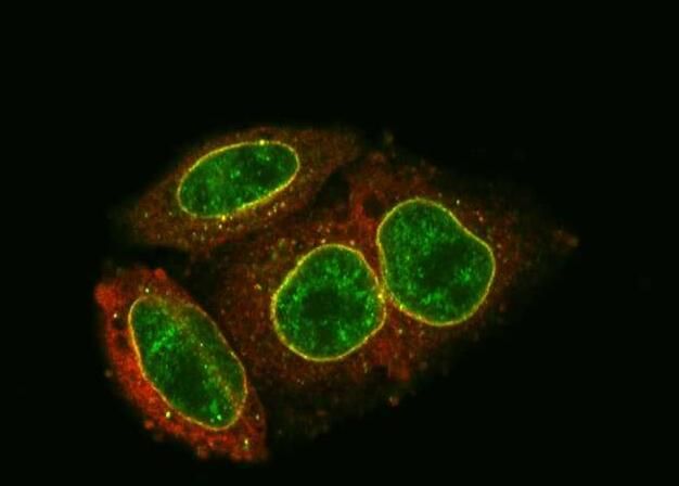 科学家阐明HIV DNA被阻止进入细胞核的分子机制