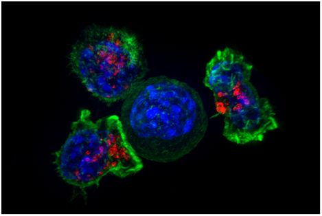 让肿瘤氧气供应正常化或是抵抗癌症的关键