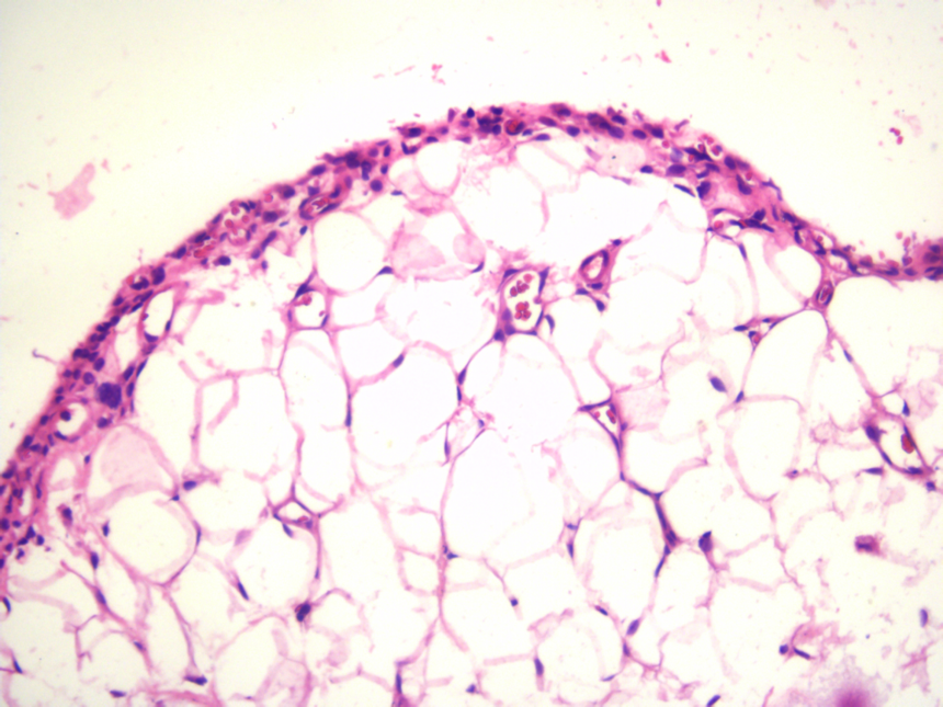 大鼠骨关节炎模型制备