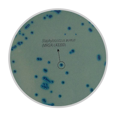 特异性分离鉴别耐甲氧西林金葡菌的方法