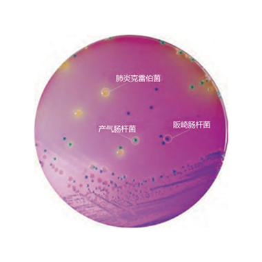 国标优选阪崎克罗诺杆菌显色培养基