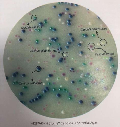 念珠菌的鉴定方法