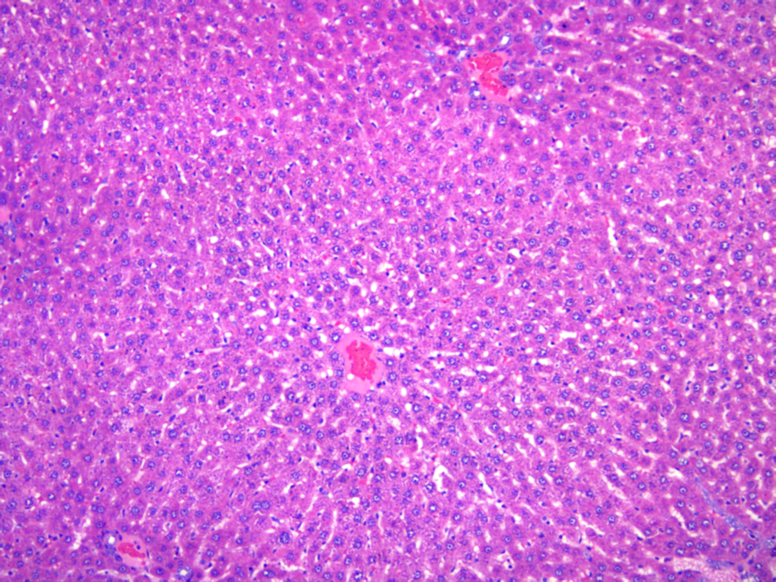 教你制作常见的大鼠肝硬化模型构建