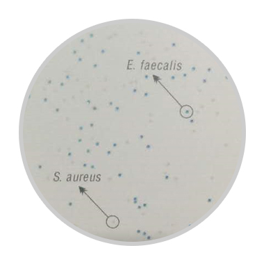 快速分离水中肠球菌的方法