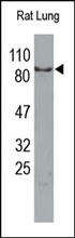 The TLR2 Antibody (Cat. No. 251110) is used in Western blot to detect TLR2 in rat lung lysates.