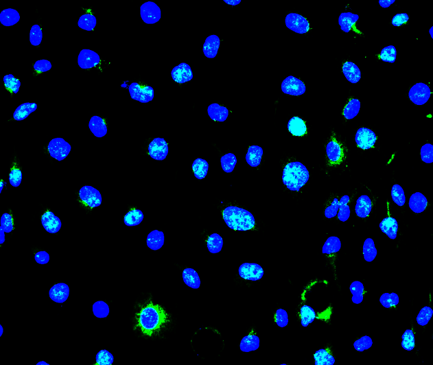 免疫荧光，免疫荧光实验代测