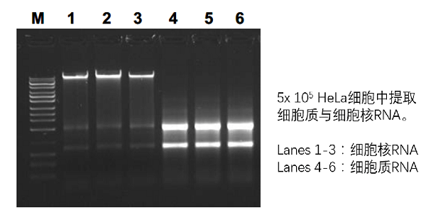 Hela细胞中提取细胞质与细胞核RNA