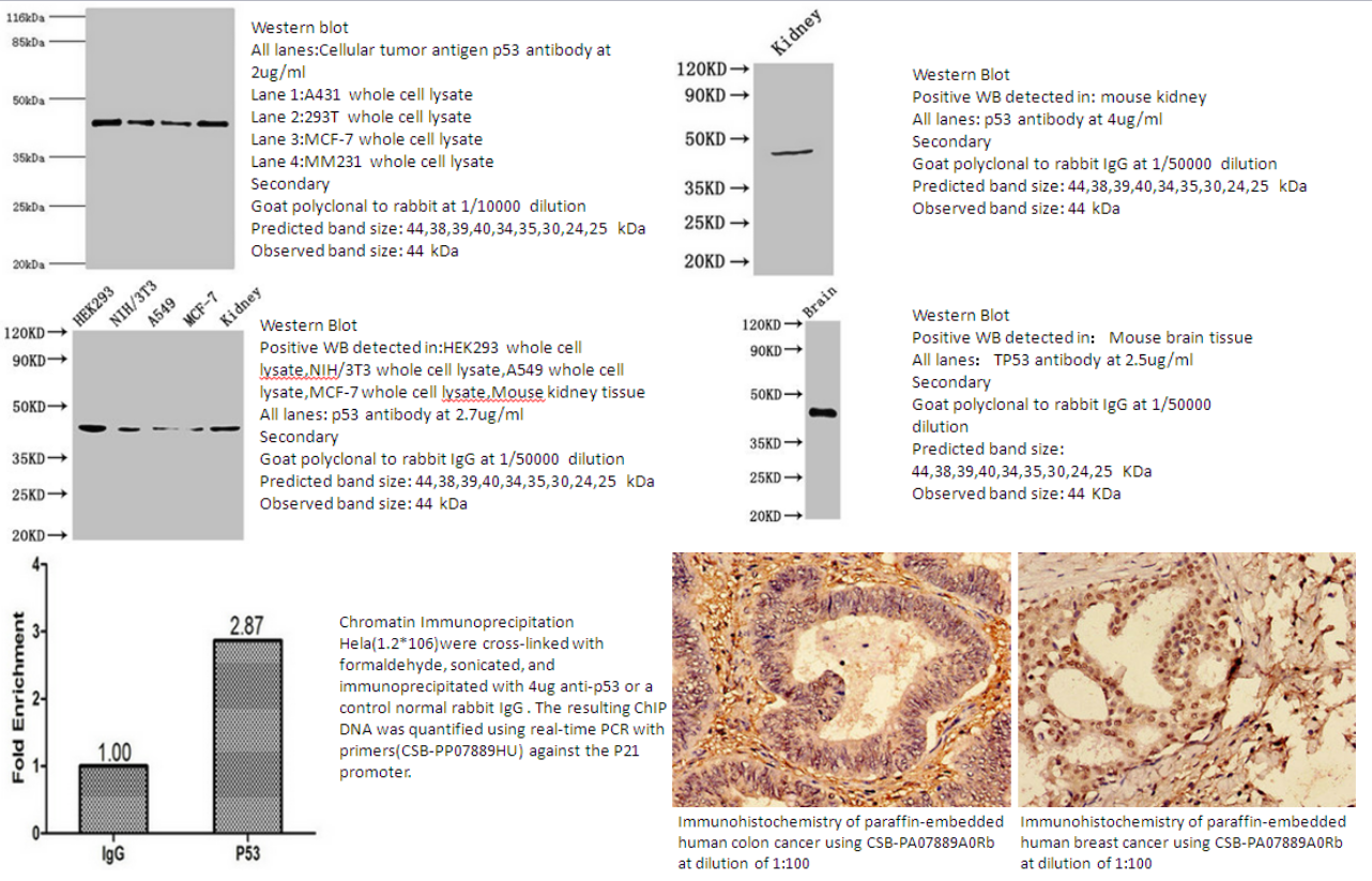 我的后半生——自噬