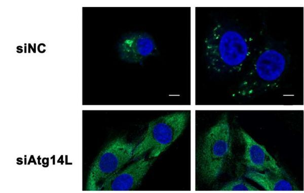 特殊蛋白来帮忙 不用手术也能治疗心脏疾病