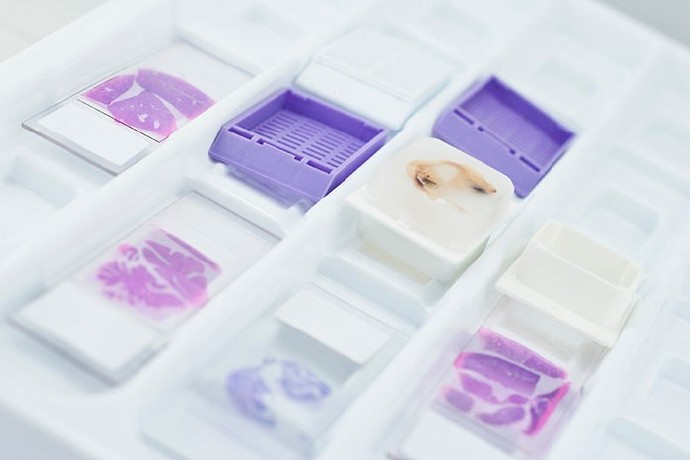 FFPE RNA/DNA纯化试剂盒：石蜡包埋组织样本RNA/DNA纯化方案