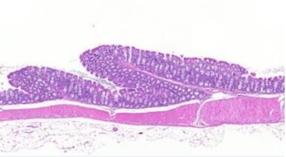 为何女性比男性更容易患自身免疫性疾病？原来是雌激素受体在作怪！