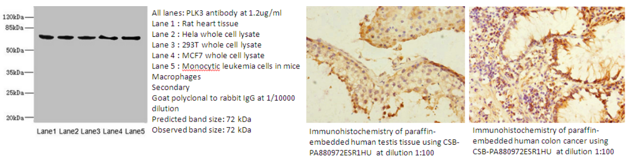 我的后半生——自噬