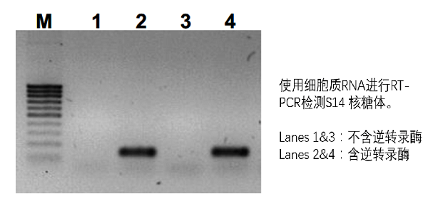 使用细胞质RNA进行RT-PCR检测S14核糖体