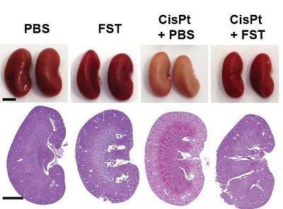 【前沿资讯】STM:新发现可缓解化疗导致的肾脏损伤