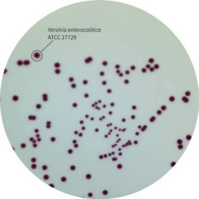引起急性胃肠炎型食物中毒的元凶--小肠结炎耶尔森氏菌