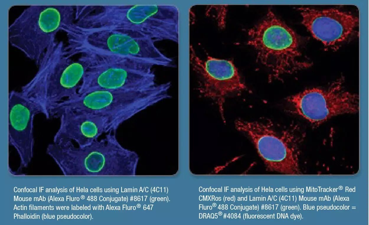 免疫荧光几多愁，5步收获出版图