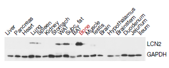 脂质运载蛋白2（LCN2）新发现