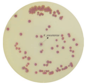 HiMedia特有的克雷伯菌显色培养基