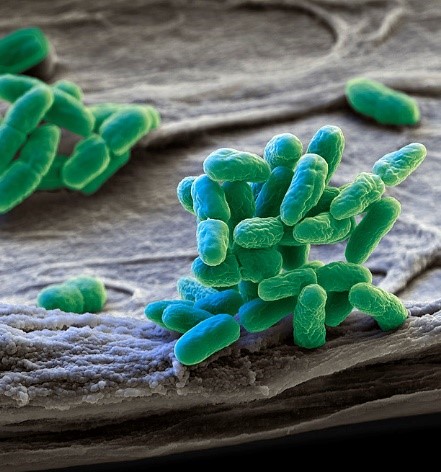 当新鲜空气成为奢侈品？——浅谈GC-MS在呼吸气检测中的应用