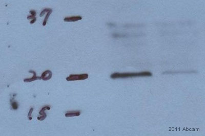 Western blot - Anti-Bax antibody [6A7] (ab5714)
