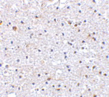 Immunohistochemistry of PD-1 in human brain tissue with PD-1 Antibody (Cat. No. 253701) at 2.5 ug/mL.