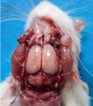 大鼠脑外伤动物模型（TBI）的建立