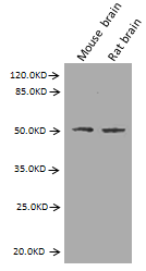 神经胶质纤维酸性蛋白（GFAP）单克隆抗体