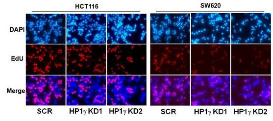 Cancer Research：结直肠癌调控机制新发现 