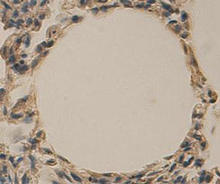 Formalin-fixed paraffin-embedded human lung tissue is stained with AKR1C3 Antibody (Cat. No. 252019) used at 1:100 dilution.