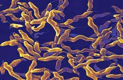 容易忽视的腹泻元凶——空肠弯曲菌