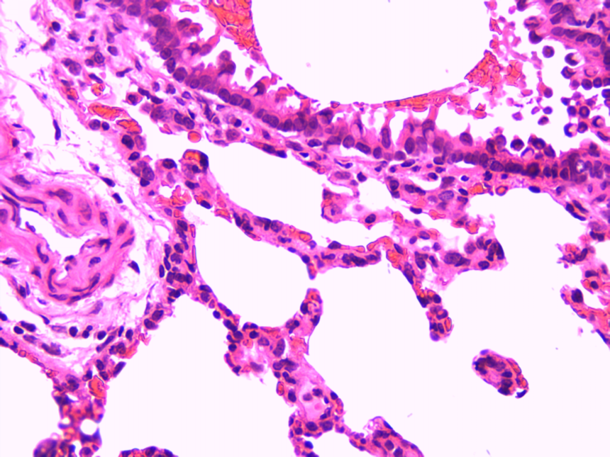 大鼠慢性阻塞性肺疾病(COPD)模型制备