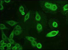 AKR1C3 immunofluorescent staining in HeLa cells. HeLa cells are stained with AKR1AC3 Antibody (Cat. No. 252019) used at 1:50 dilution.