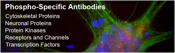 磷酸化抗体--专业精确检测磷酸化蛋白的好选择